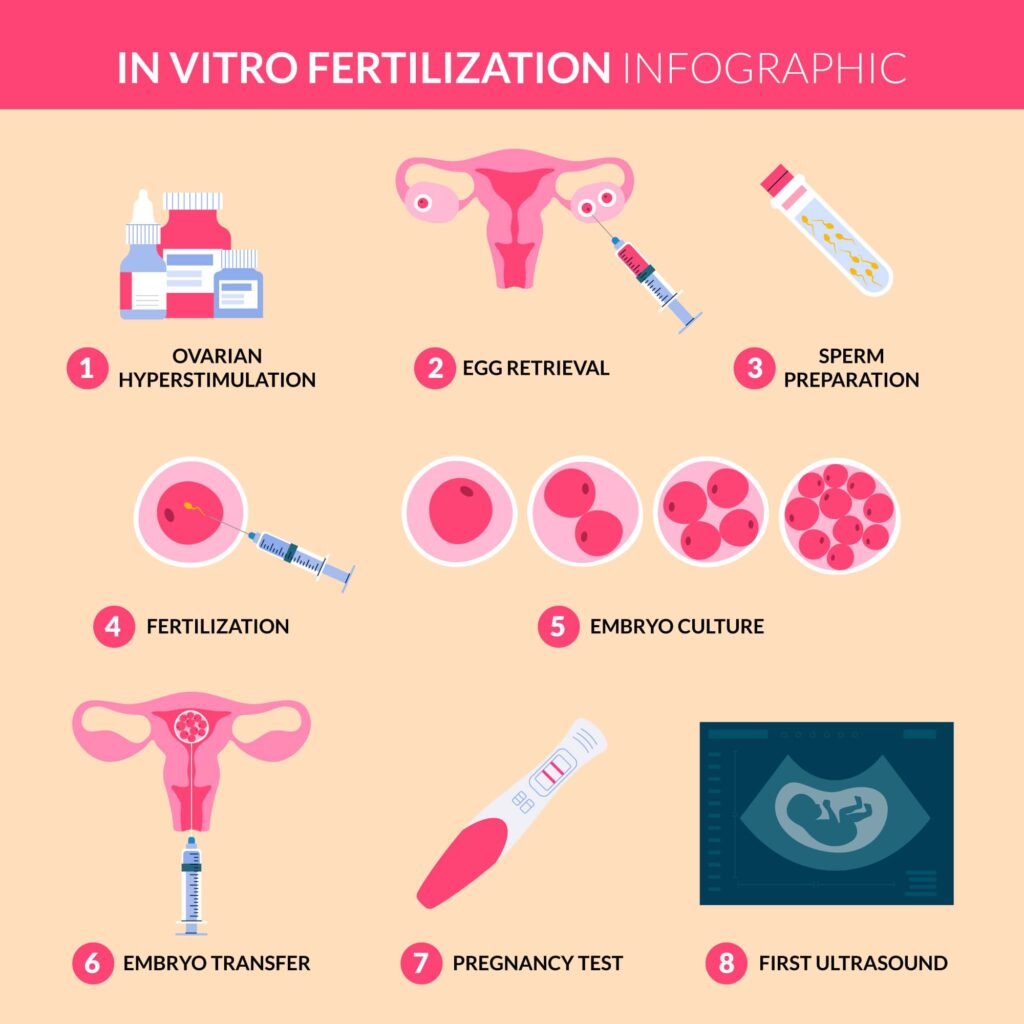 an illustration for one of alternatives for PCOS treatment for fertility